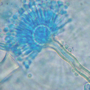 aspergillus Picture of aspergillus under microscope