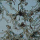 cladosporium Cladosporium is a common mold that has been associated with allergies