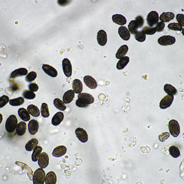 stachybotrys Picture of Stachybotrys Spores